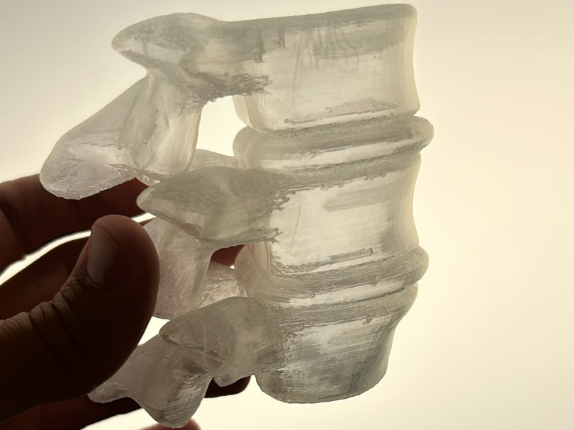 Vertebra L3-L5 translucent for dry needling bits