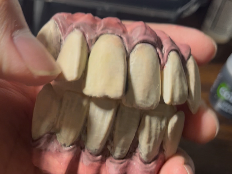 AirPods 1/2 Case teeth