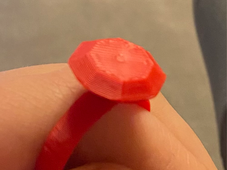 simple ring