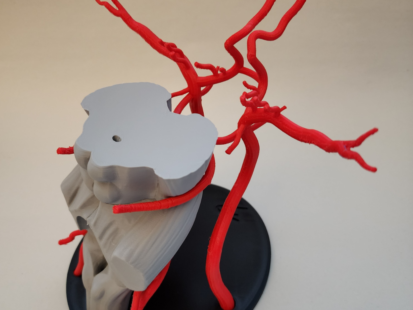Circle of Willis/Arteries of the Brain