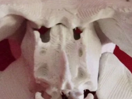 Ethmoid with Perpendicular Plate