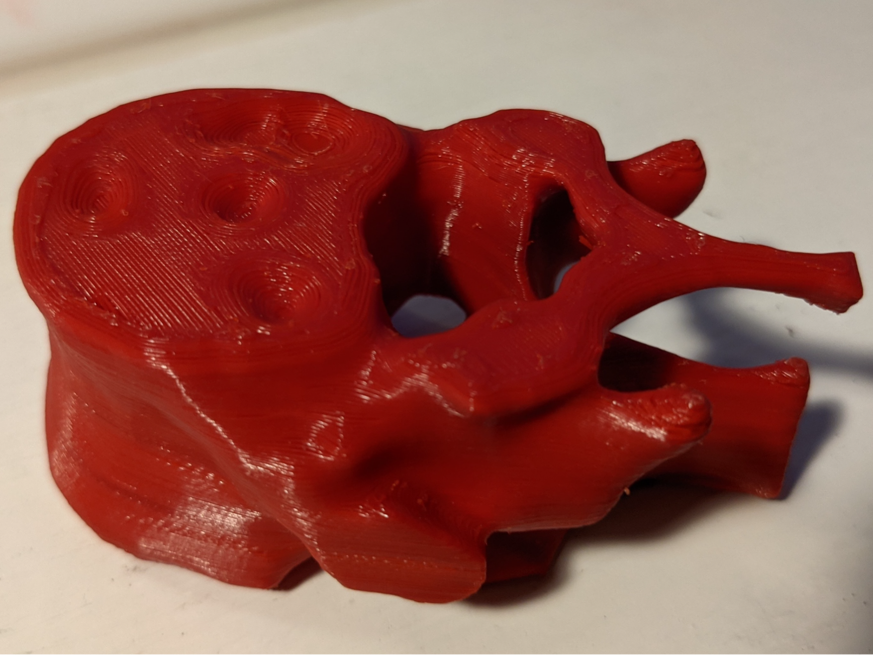 Real human spinal vertebra - from CT scan
