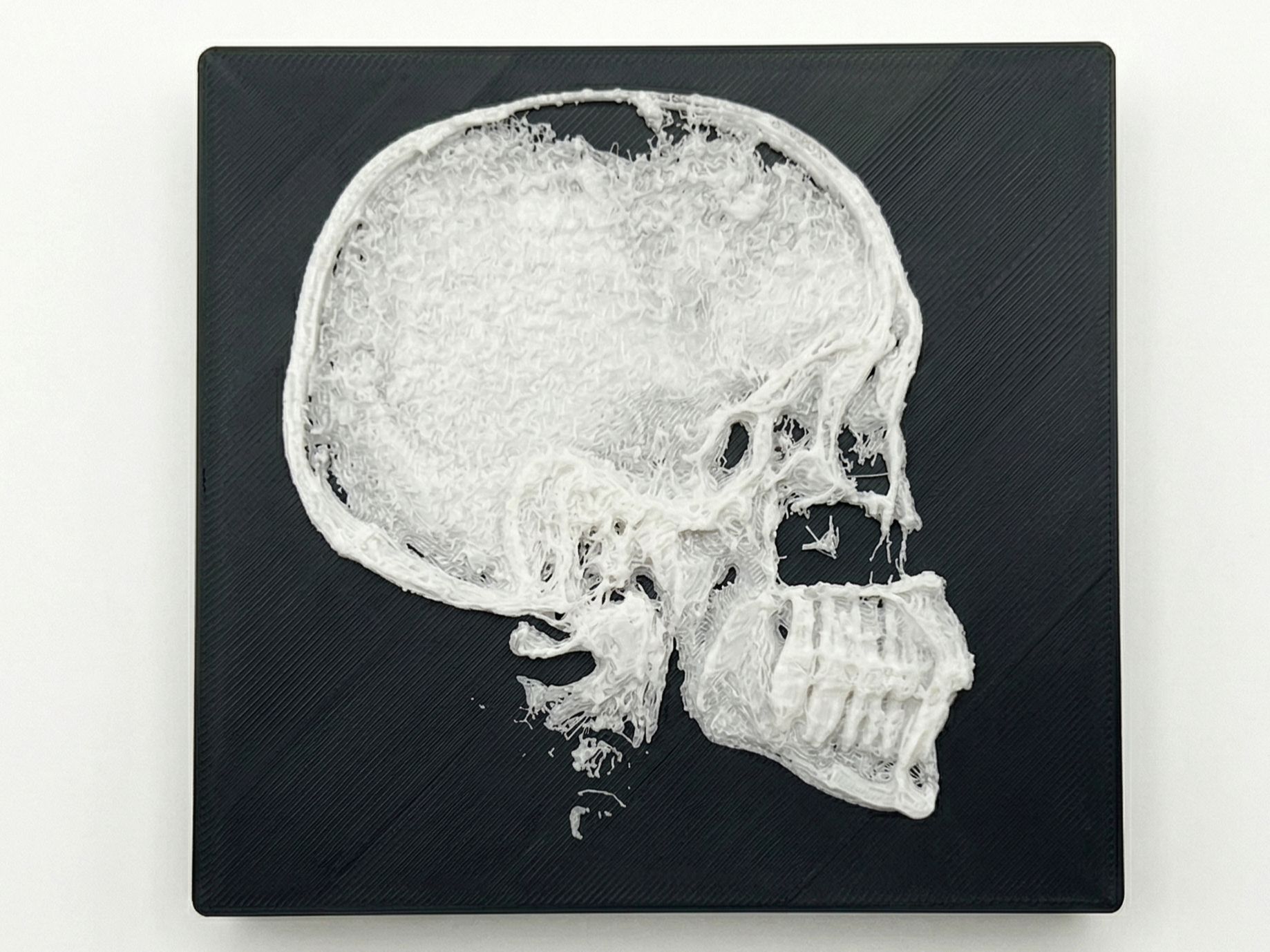 Anatomia X-Ray Realistica: Profilo Cranico
