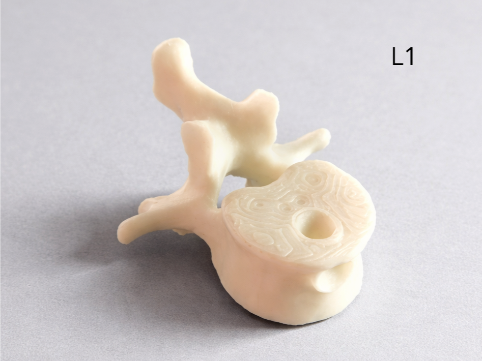 L1 Lumbar Vertebra Keychain – Anatomy Spine Model