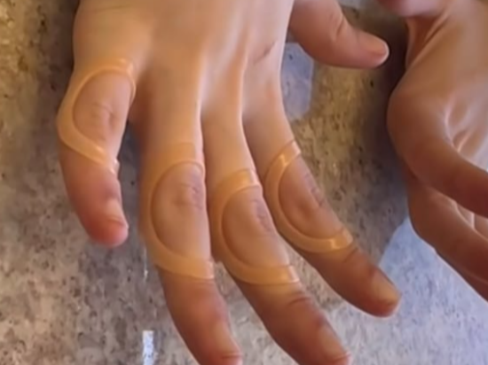 Órtese Oval-8 - Finger Splint
