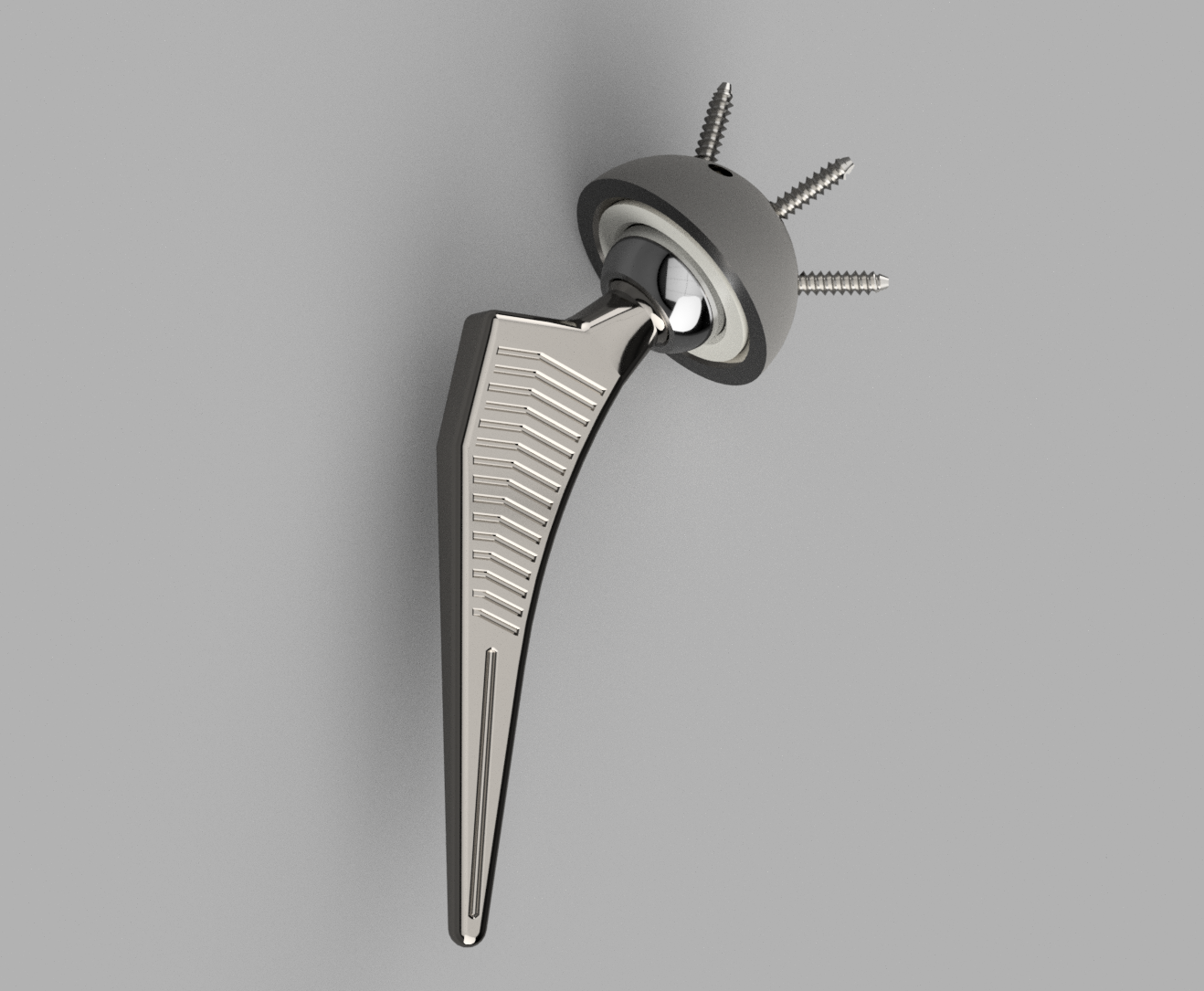 Orthopedic Insights: Total Hip Replacement Model