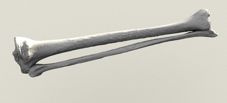 Human Tibia and Fibula
