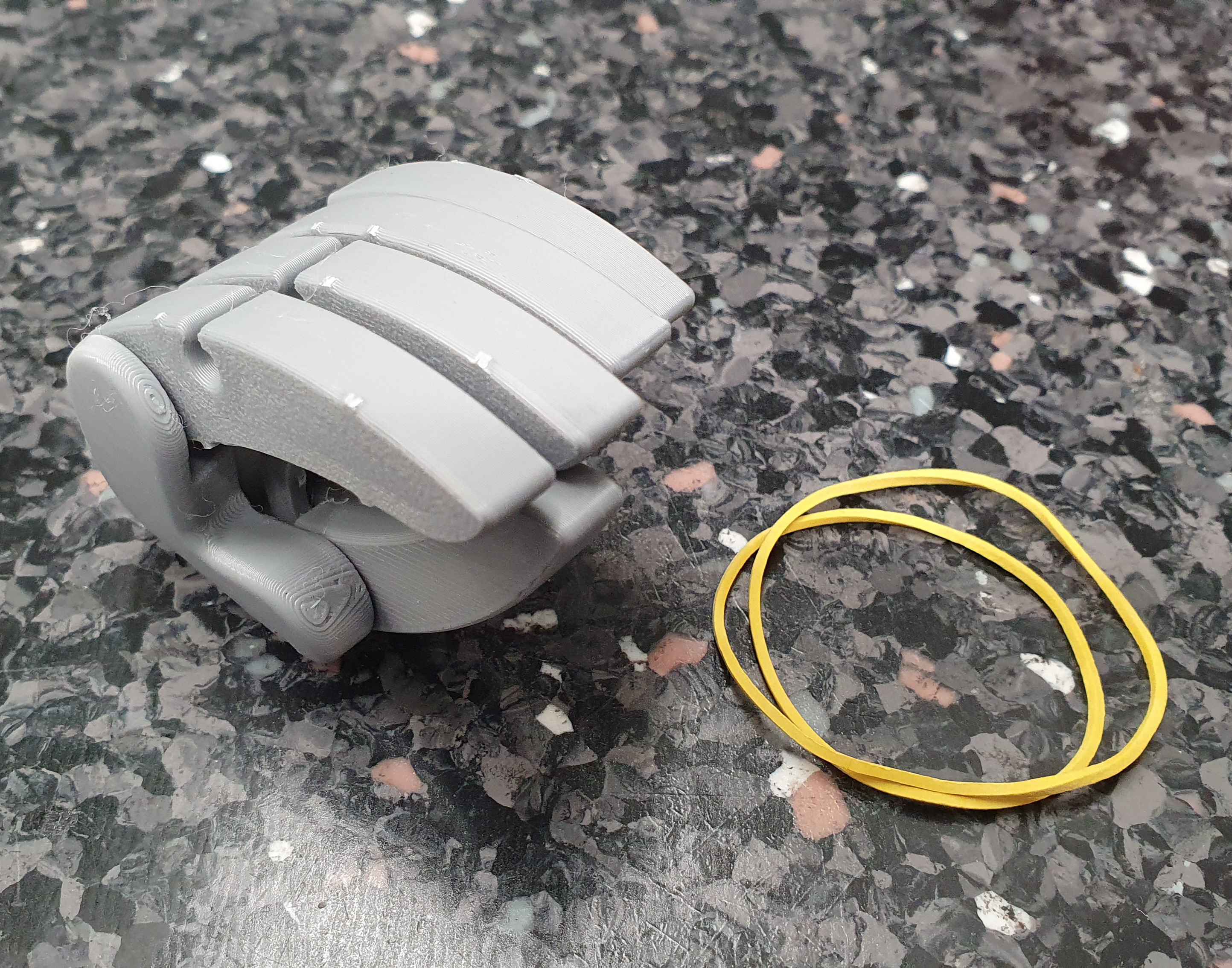 prosthetic hand assembly kit